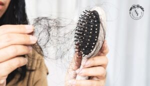 Hair Fall